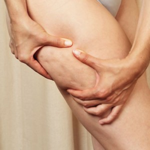 cellulite-coscia-buccia-arancia